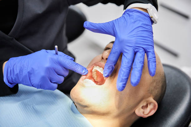 Best Emergency Dental Extractions in Pacific, WA